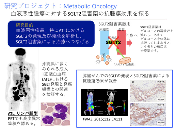 血液悪性腫瘍に対するSGLT2阻害薬の抗腫瘍効果を探る